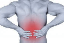 Physio for Sciatica London: Expert Treatment for Pain Relief