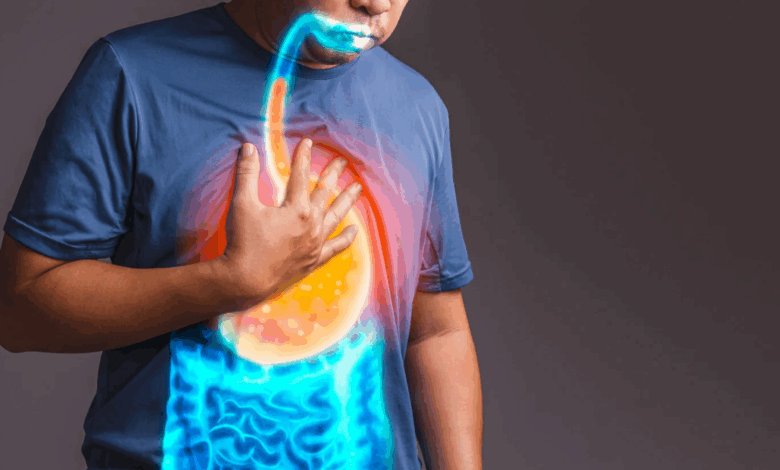 What to Expect During GERD Reflux Treatment