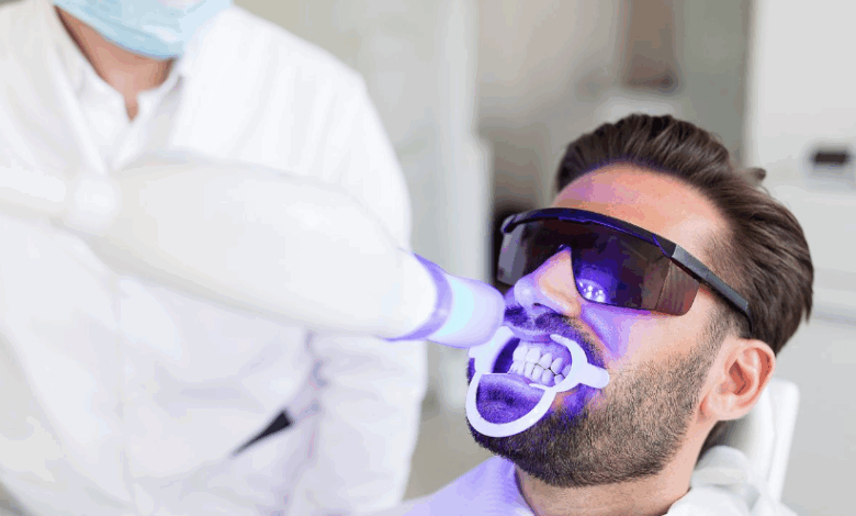 How to Keep Your Teeth White After Whitening Treatments