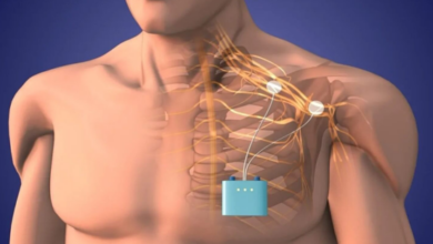 Spinal Cord Stimulation Doctors in St. Pete Florida