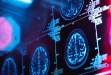 Long-Term Nerve and Brain Health Depends on Specialised Neurological Care