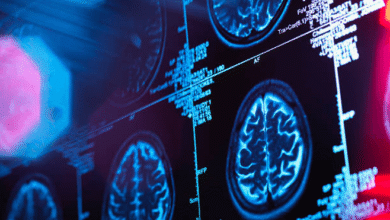 Long-Term Nerve and Brain Health Depends on Specialised Neurological Care