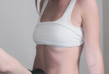 How Lifestyle Impacts Body Contouring Results Over Time