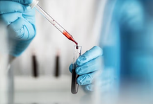 Understanding Private Blood Testing and Modern Health Monitoring