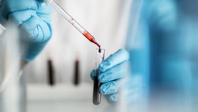 Understanding Private Blood Testing and Modern Health Monitoring