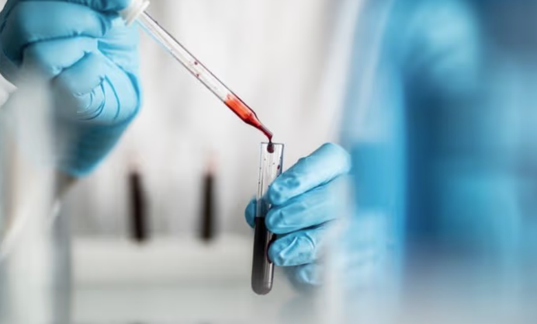 Understanding Private Blood Testing and Modern Health Monitoring